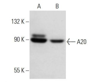 A20/TNFAIP3 Antibody (59A426) - Western Blotting - Image 15024 