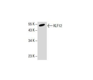 A2058 Whole Cell Lysate: sc-364178. Western blot analysis of KLF12... 