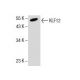 A2058 Whole Cell Lysate: sc-364178. Western blot analysis of KLF12... 