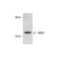 A2058 Whole Cell Lysate: sc-364178. Western blot analysis of VRK2...