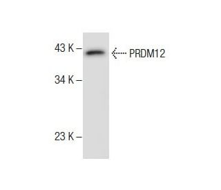 A549 Cell Lysate: sc-2413. Western blot analysis of PRDM12 expression... 