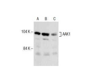 AAK1 Antibody (LW-M11) - Western Blotting - Image 153656 