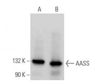 AASS Antibody (B-7) - Western Blotting - Image 374922 