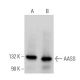 AASS Antibody (B-7) - Western Blotting - Image 374922 