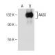 AASS Antibody (D-8) - Western Blotting - Image 149999