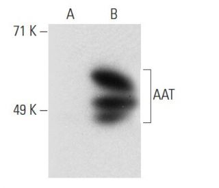 AAT Antibody (13702) - Western Blotting - Image 21127