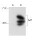 AAT Antibody (13702) - Western Blotting - Image 21127
