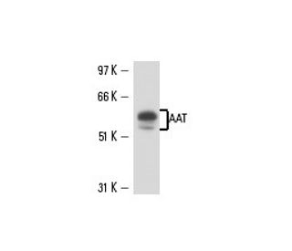 AAT Antibody (702) - Western Blotting - Image 15638 
