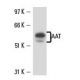 AAT Antibody (702) - Western Blotting - Image 15638 