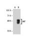 AAT Antibody (702) - Western Blotting - Image 21121