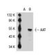 AAT Antibody (702) - Western Blotting - Image 31831 