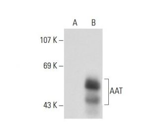 AAT Antibody (9) - Western Blotting - Image 70565 
