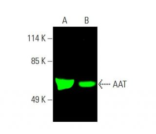 AAT Antibody (H-7) - Western Blotting - Image 387051 
