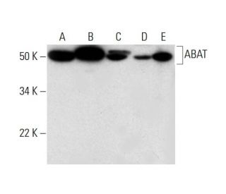 ABAT Antibody (B-5) - Western Blotting - Image 294114 