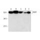 ABAT Antibody (B-5) - Western Blotting - Image 294114 