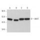 ABAT Antibody (B-5) - Western Blotting - Image 366713 