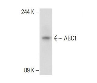ABC1 Antibody (AB.H10) - Western Blotting - Image 108981 