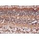 ABCA4 Antibody (3F4) - Immunohistochemistry - Image 378055 