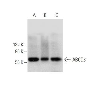 ABCD3 Antibody (F-1) - Western Blotting - Image 326561 