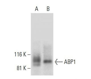 ABP1 Antibody (F-9) - Western Blotting - Image 300431SAM Transcription Activation: SAM system utilizing dCas9-VP64, MS2-P65-HSF1, and sgRNA for precise gene transcription activation.