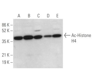 Ac-Histone H4 [Ser 1/Lys 5/Lys 8/Lys 12] Antibody (G-2) - Western Blotting - Image 376637 