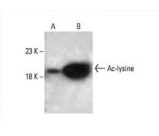 Ac-lysine Antibody (7F8) - Western Blotting - Image 392604 