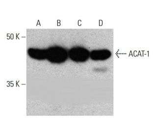 ACAT-1 Antibody (AT15E5) - Western Blotting - Image 384043The Double Nickase Plasmid features a U6 promoter for sgRNA expression, a 20 nt targeting sequence, and a gRNA scaffold to guide Cas9n. It includes a CBh promoter for Cas9n (D10A) and puromycin resistance, GFP for transfection verification, and nuclear localization signals (NLS). The 2A peptide allows co-expression of Cas9n and Puro from a single promoter, enabling precise genome editing with reduced off-target effects.
