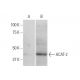 ACAT-2 Antibody (4A5) - Western Blotting - Image 347532 