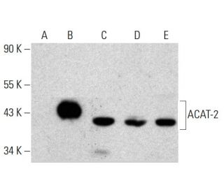 ACAT-2 Antibody (4A5) - Western Blotting - Image 384041SAM Transcription Activation: SAM system utilizing dCas9-VP64, MS2-P65-HSF1, and sgRNA for precise gene transcription activation.