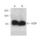 ACBP Antibody (C-9) - Western Blotting - Image 358578 