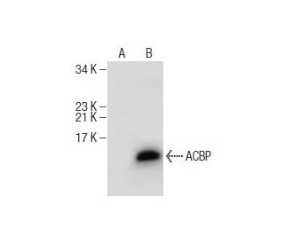 ACBP Antibody (C-9) - Western Blotting - Image 159768