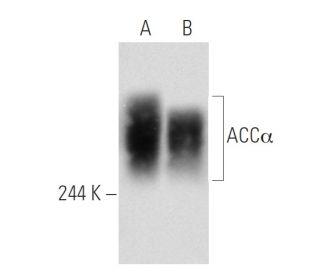 ACCα Antibody (D-5) - Western Blotting - Image 58513The Double Nickase Plasmid features a U6 promoter for sgRNA expression, a 20 nt targeting sequence, and a gRNA scaffold to guide Cas9n. It includes a CBh promoter for Cas9n (D10A) and puromycin resistance, GFP for transfection verification, and nuclear localization signals (NLS). The 2A peptide allows co-expression of Cas9n and Puro from a single promoter, enabling precise genome editing with reduced off-target effects.