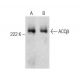 ACCβ Antibody (F-9) - Western Blotting - Image 283463