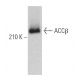 ACCβ Antibody (H-7) - Western Blotting - Image 373382 
