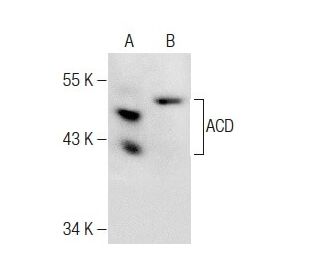 ACD Antibody (A-8) - Western Blotting - Image 283627 