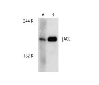 ACE Antibody (B-6) - Western Blotting - Image 149002 
