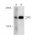 ACE Antibody (B-6) - Western Blotting - Image 149002 