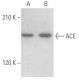 ACE Antibody (B-6) - Western Blotting - Image 354628