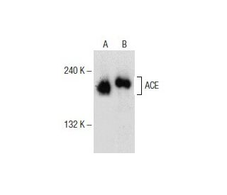 ACE Antibody (H-9) - Western Blotting - Image 154040