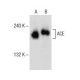 ACE Antibody (H-9) - Western Blotting - Image 154040