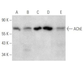 AChE Antibody (A-11) - Western Blotting - Image 354798Each CRISPR/Cas9 Knockout (KO) Plasmid product consists of a pool of 3 plasmids designed to ensure identification and cleavage of a specific gene for maximum knockout efficiency. Each plasmid encodes a unique 20 nt sequence derived from the GeCKO (v2) library.