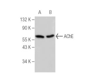 AChE Antibody (A-11) - Western Blotting - Image 147142 