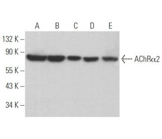 Nicotinic Acetylcholine Receptor alpha 2/CHRNA2 Antibody (H-8) - Western Blotting - Image 365096 
