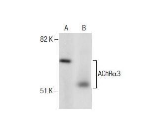 Nicotinic Acetylcholine Receptor alpha 3/CHRNA3 Antibody (313) - Western Blotting - Image 260748