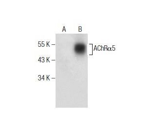 Nicotinic Acetylcholine Receptor alpha 5/CHRNA5 Antibody (D-11) - Western Blotting - Image 164537 