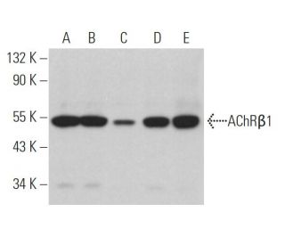 Nicotinic Acetylcholine Receptor beta 1/CHRNB1 Antibody (123) - Western Blotting - Image 363985 