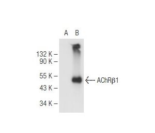Nicotinic Acetylcholine Receptor beta 1/CHRNB1 Antibody (A-2) - Western Blotting - Image 84099