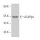 Nicotinic Acetylcholine Receptor beta 1/CHRNB1 Antibody (E-2) - Western Blotting - Image 363983 