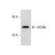 Nicotinic Acetylcholine Receptor delta/CHRND Antibody (137) - Western Blotting - Image 282055
