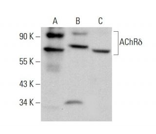 Nicotinic Acetylcholine Receptor delta/CHRND Antibody (137) - Western Blotting - Image 379835 